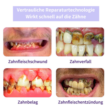Zahnreparatur-Mineralpuder💧Cvreoz®(Empfohlen von der EAD)Zusätzliche 30 % Rabatt