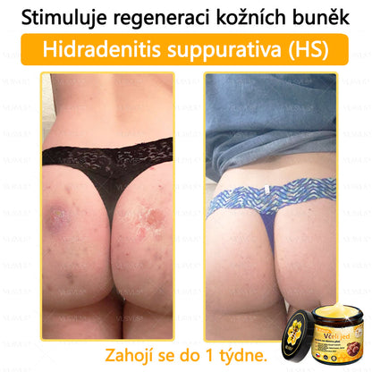 💥VLSVLS™ Obnovující krém se včelím jedem🐝