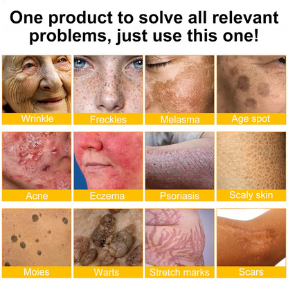 💥Schváleno TGA: Ourlyard® Bee venom Pro komplexní krém — 🔥Časově omezená sleva 80 %🔥