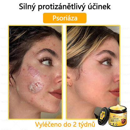 💥VLSVLS™ Obnovující krém se včelím jedem🐝