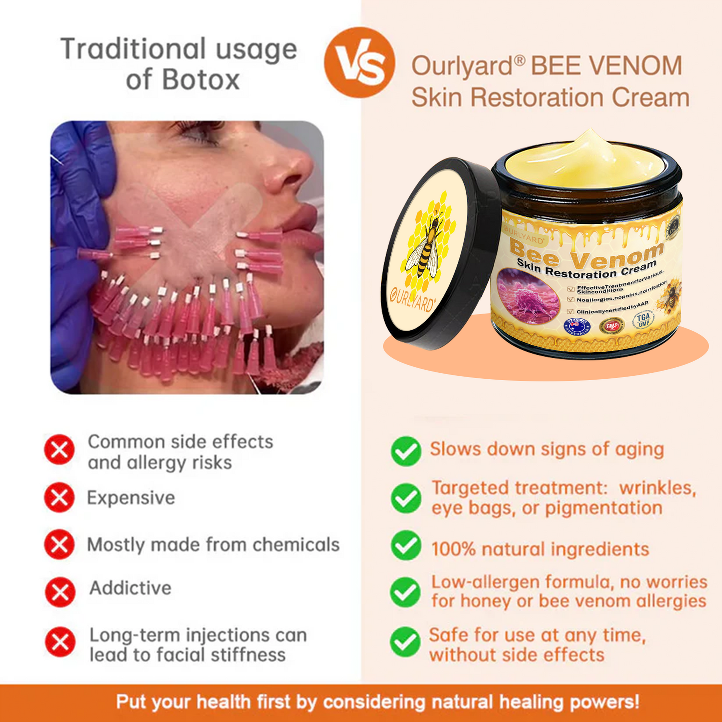 💥Schváleno TGA: Ourlyard® Bee venom Pro komplexní krém — 🔥Časově omezená sleva 80 %🔥