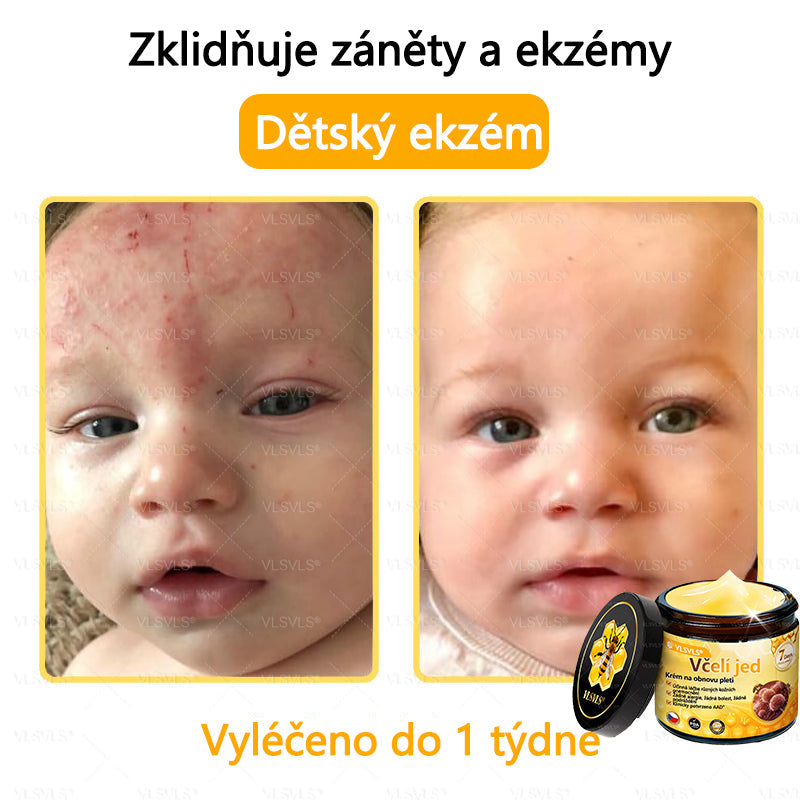 💥VLSVLS™ Obnovující krém se včelím jedem🐝