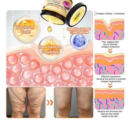 💥Schváleno TGA: Ourlyard® Bee venom Pro komplexní krém — 🔥Časově omezená sleva 80 %🔥