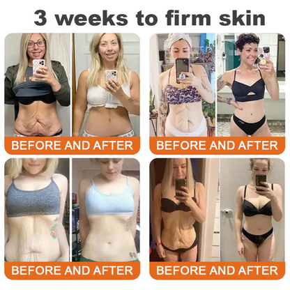 💥Schváleno TGA: Ourlyard® Bee venom Pro komplexní krém — 🔥Časově omezená sleva 80 %🔥